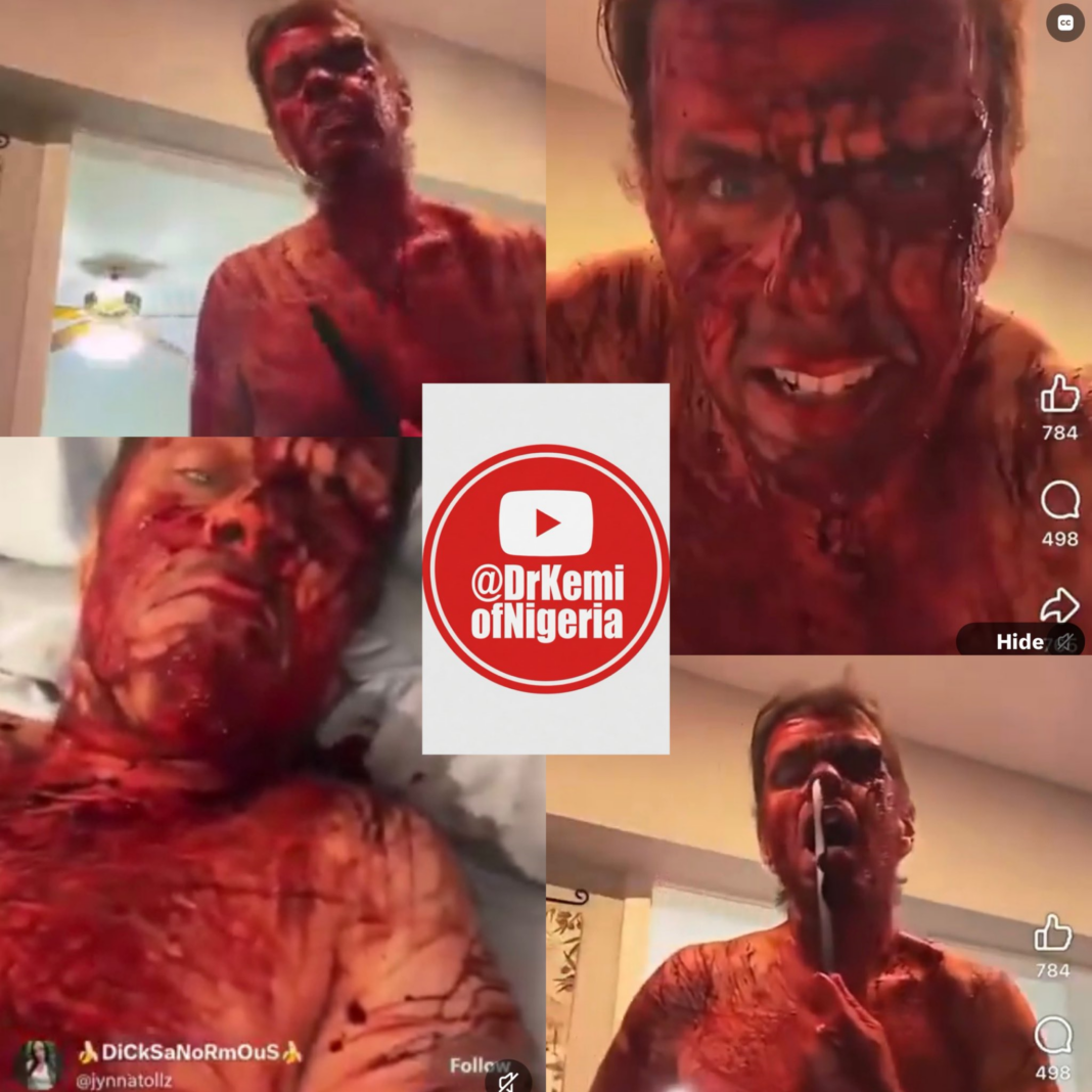 perez hilton sucide attempt